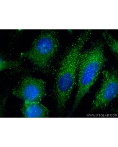 AP2A1 Polyclonal antibody 29887-1-AP proteintech
