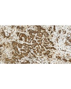 DOCK5 Polyclonal antibody 29938-1-AP proteintech