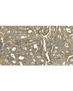 AP2A1 Polyclonal antibody 30030-1-AP proteintech