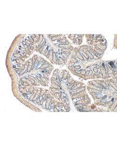 Periphilin 1 Polyclonal antibody 30437-1-AP proteintech