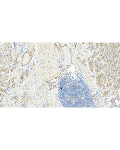 ZO-1 Polyclonal antibody 30487-1-AP proteintech