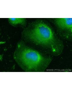 CBR1 Polyclonal antibody 31279-1-AP proteintech