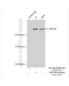 ZNF638 Polyclonal antibody 31300-1-AP proteintech