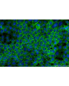 CD138/Syndecan-1 Polyclonal antibody 31341-1-AP proteintech
