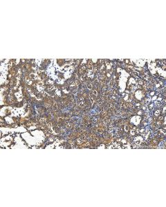 PPP1R21 Polyclonal antibody 31532-1-AP proteintech