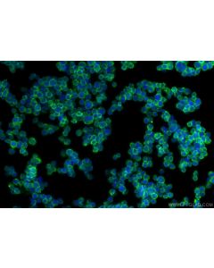 CD2 Polyclonal antibody 31803-1-AP proteintech