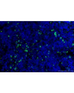 CEACAM-1/CD66a Polyclonal antibody 32395-1-AP proteintech