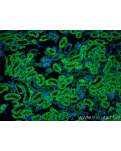 AP3S1 Polyclonal antibody 32945-1-AP proteintech