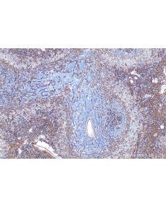 VCAM-1/CD106 Polyclonal antibody 33377-1-AP proteintech