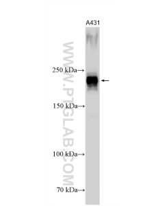 CCDC88A Polyclonal antibody 33569-1-AP proteintech