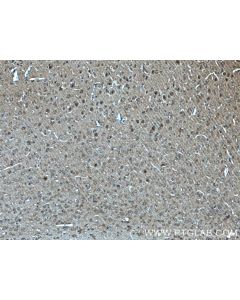 SNIP/p140Cap Polyclonal antibody 55362-1-AP proteintech
