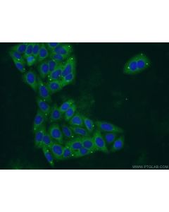 PYGL Polyclonal antibody 55429-1-AP proteintech