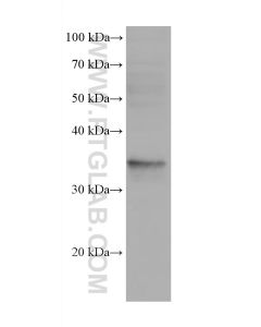 IL-20RB Monoclonal antibody 60221-1-Ig proteintech