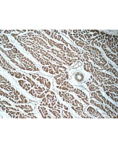 Myocilin Monoclonal antibody 60357-1-Ig proteintech