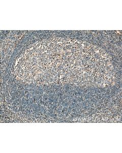 IRF4 Monoclonal antibody 66451-1-Ig proteintech