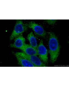 Caspase 3/P17/P19 Monoclonal antibody, PBS Only 66470-2-PBS proteintech