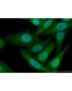 Thioredoxin 1 Monoclonal antibody 66475-1-Ig proteintech