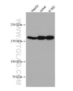 Thrombospondin 1 Monoclonal antibody 67241-1-Ig proteintech