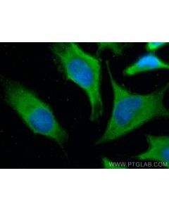 Profilin 1 Monoclonal antibody 67390-1-Ig proteintech