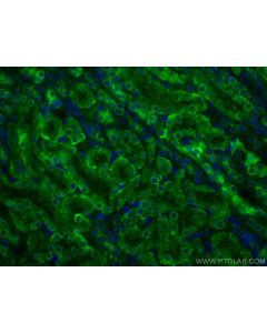 Arfaptin-1 Monoclonal antibody 67461-1-Ig proteintech
