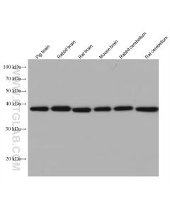 Endophilin 1 Monoclonal antibody 68029-1-Ig proteintech