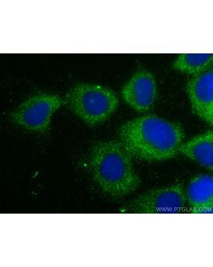 UBE2D1/2/3/4 Monoclonal antibody 68138-1-Ig proteintech