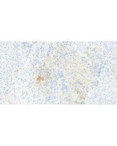 uPAR/CD87 Monoclonal antibody, PBS Only 68727-1-PBS proteintech