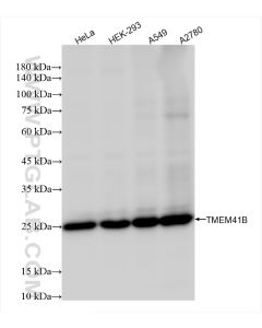 TMEM41B Recombinant monoclonal antibody, PBS Only 84510-4-PBS proteintech