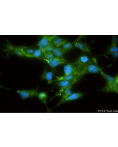 AMACR/p504S Recombinant monoclonal antibody, PBS Only 84891-2-PBS proteintech