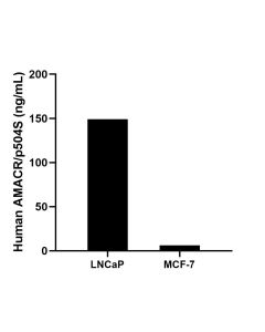 AMACR/p504S Recombinant monoclonal antibody, PBS Only (Detector) 84891-3-PBS proteintech