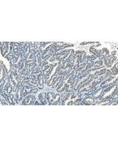 HEXIM1 Recombinant monoclonal antibody 85028-1-RR proteintech