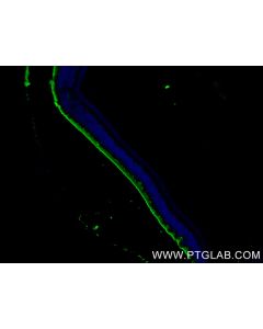 PRPH2 Recombinant monoclonal antibody 85043-1-RR proteintech