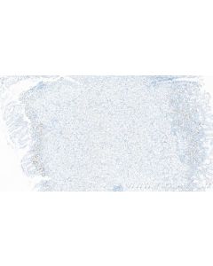 CKAP2 Recombinant monoclonal antibody 86689-1-RR proteintech