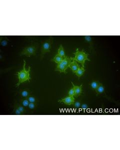 CD11a Recombinant monoclonal antibody 87542-1-RR proteintech