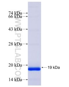 Recombinant human IL-13 protein Ag25853 proteintech