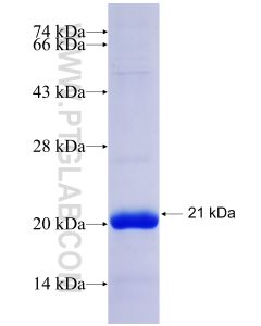 Recombinant human ADAMTS5 protein Ag26730 proteintech