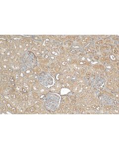 Biotin-conjugated t-Plasminogen activator/tPA Polyclonal antibody Biotin-10147 proteintech