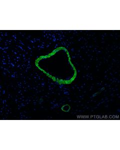 CoraLite® Plus 488-conjugated transgelin/SM22 Polyclonal antibody CL488-10493 proteintech