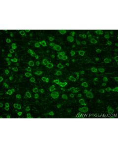 CoraLite® Plus 488-conjugated Galc Polyclonal antibody CL488-11991 proteintech