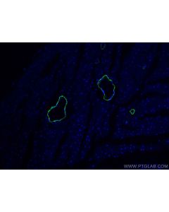 CoraLite® Plus 488-conjugated Alpha smooth muscle actin Polyclonal antibody CL488-14395 proteintech