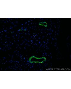 CoraLite® Plus 488-conjugated Alpha smooth muscle actin specific Monoclonal antibody CL488-67735 proteintech