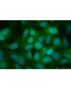 CoraLite® Plus 488-conjugated Chk1 Recombinant monoclonal antibody CL488-84905 proteintech