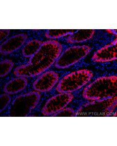 CoraLite®555-conjugated pan-keratin Polyclonal antibody CL555-26411 proteintech