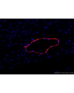 CoraLite®594-conjugated transgelin/SM22 Polyclonal antibody CL594-10493 proteintech