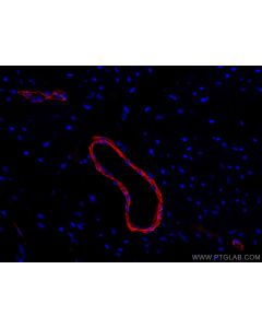 CoraLite®594-conjugated Alpha smooth muscle actin Polyclonal antibody CL594-14395 proteintech
