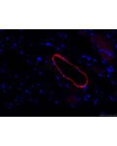 CoraLite®594-conjugated transgelin/SM22 Monoclonal antibody CL594-60213 proteintech