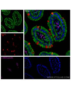 CoraLite® Plus 647-conjugated Alpha smooth muscle actin specific Recombinant monoclonal antibody CL647-80008 proteintech