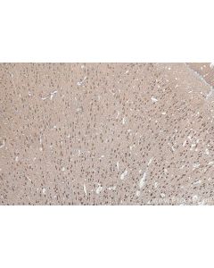 IHC easy ® UCHL1 Ready-To-Use IHC Kit KHC0054 proteintech