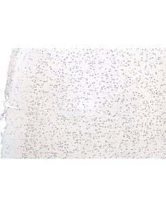 IHC easy ® FUS/TLS Ready-To-Use IHC Kit KHC0057 proteintech