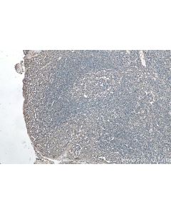 IHC easy ® HLA-E Ready-To-Use IHC Kit KHC0089 proteintech